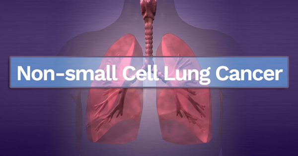 1699412222339312.png 20231009a.png