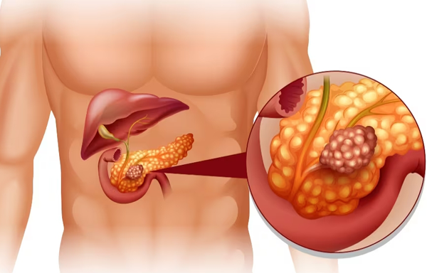 1699494220787806.png 20231107a.png